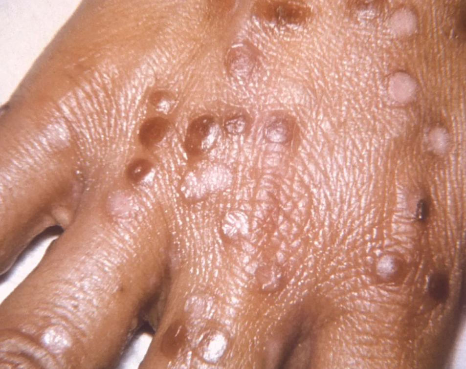 Obscure anniversary worthy of note